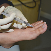 Ingrown toenail treatment at Cockburn Podiatry Cockburn Central